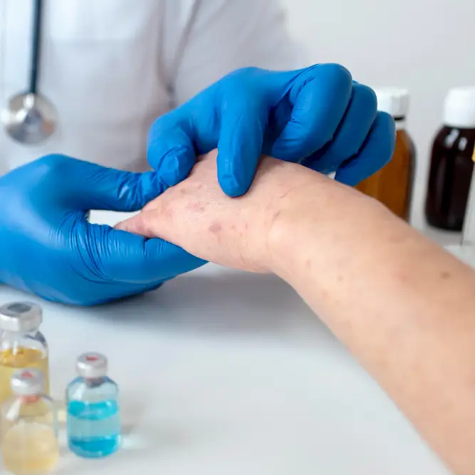 Pharmacy First Shingles - Pharmacist investigating rash